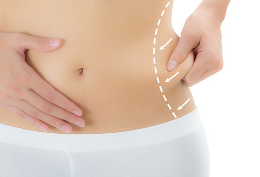 Abdominoplastia masculina